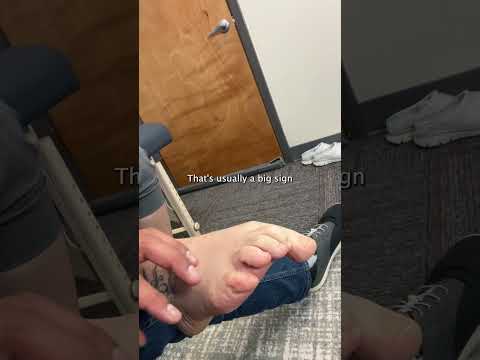 THIS is the Root Problem of Cuboid Syndrome #shorts